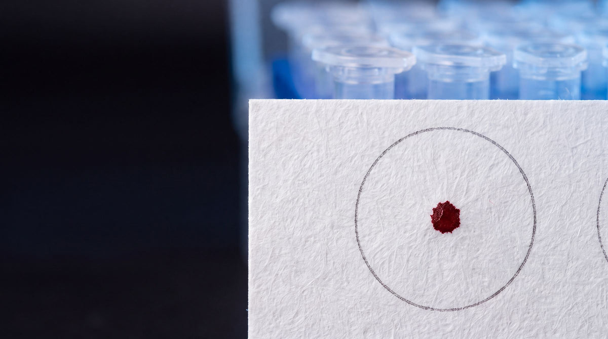 A single drop soaking into a sample card, a lab rack behind